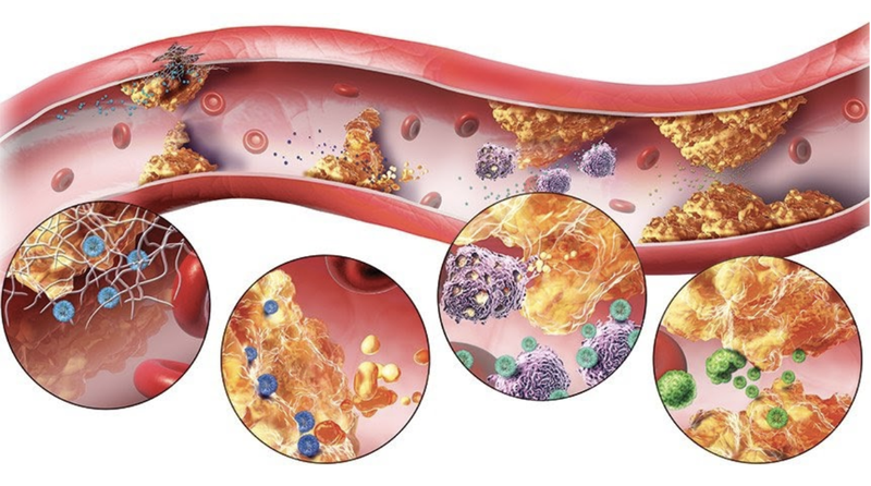 LDL cholesterol bao nhiêu là cao? Cách kiểm soát chỉ số LDC-C 1