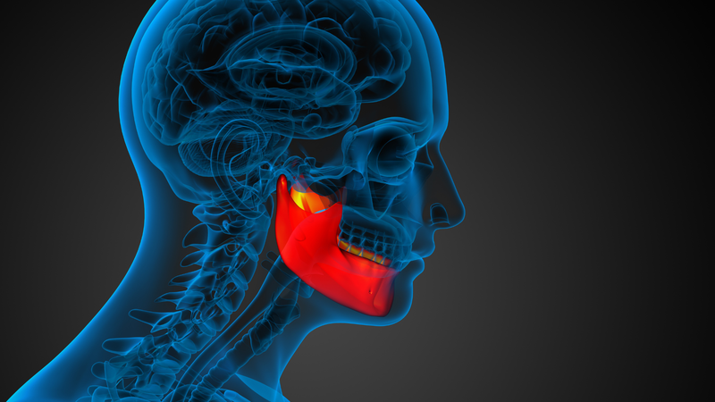 Hàm có thể bị lệch do chấn thương tại xương hàm