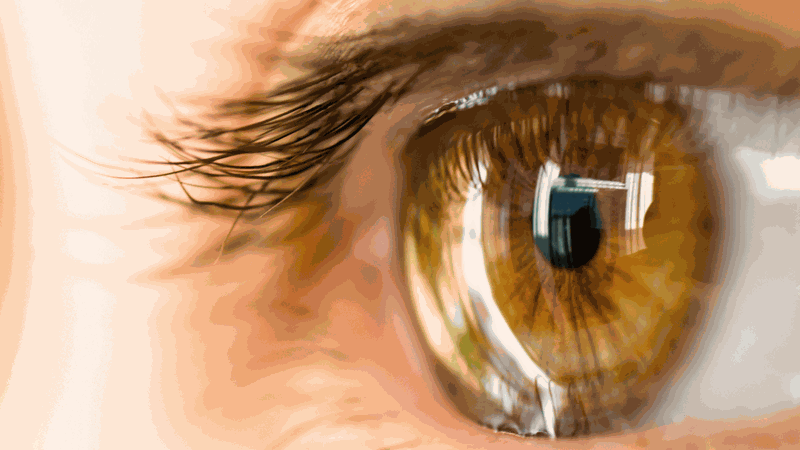 lệch khúc xạ mắt có nguy hiểm không nguyên nhân và cách phòng ngừa 1