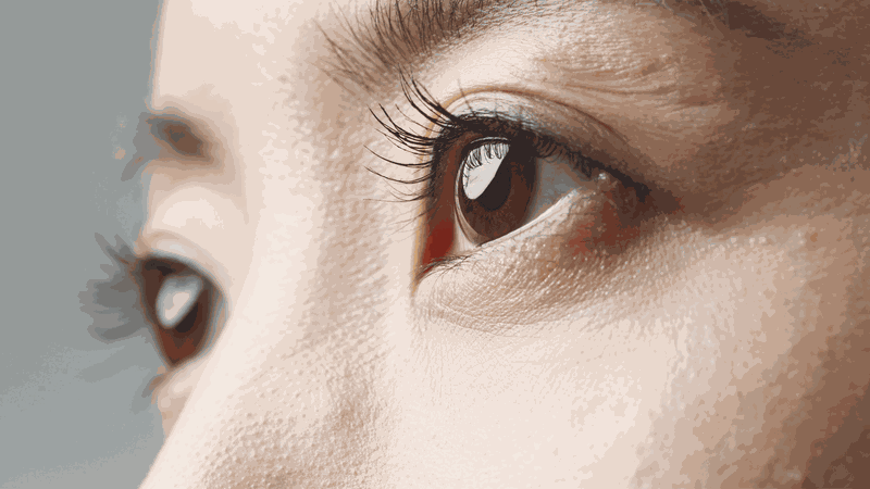 Lệch thủy tinh thể là tình trạng thủy tinh thể nằm lệch khỏi vị trí vốn có của trạng thái bình thường