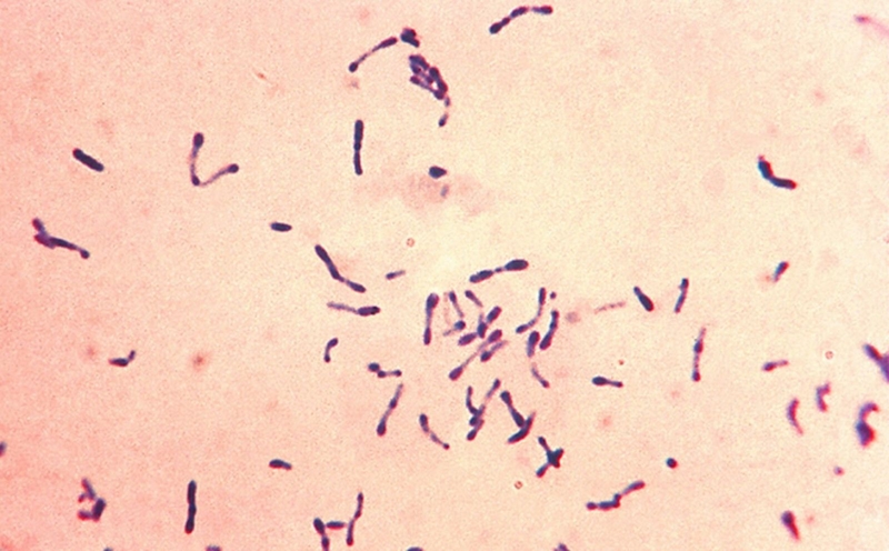 lich-tiem-chung-vacxin-bach-hau-va-nhung-luu-y-quan-trong 1