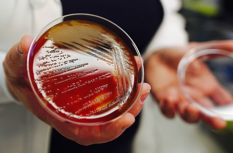 Liên cầu khuẩn nhóm B là gì? Những ảnh hưởng đối với mẹ bầu và thai nhi 4