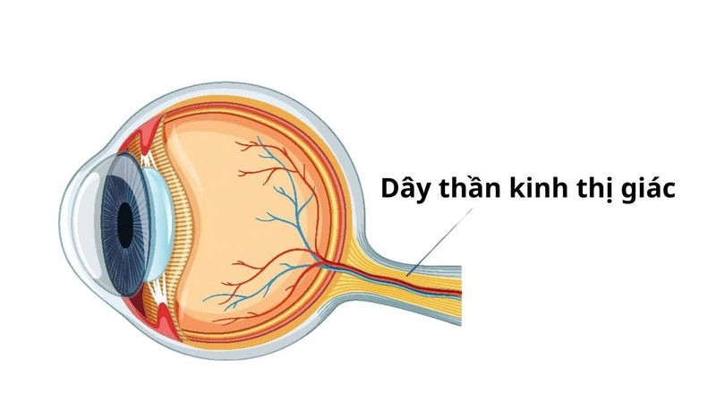 Liệt dây thần kinh số 2: Nguyên nhân, triệu chứng và cách điều trị 2