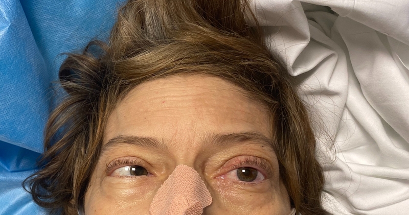 Liệt dây thần kinh số VI: Nguyên nhân, triệu chứng và điều trị 4