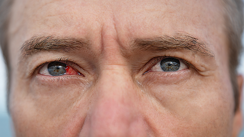 liet-day-than-kinh-so-VII-nguyen-nhan-trieu-chung-va-phuong-phap-dieu-tri 3.png