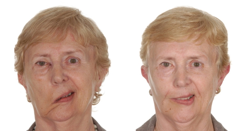 liet-mat-do-lanh-dau-hieu-nhan-biet-va-cach-khac-phuc 2