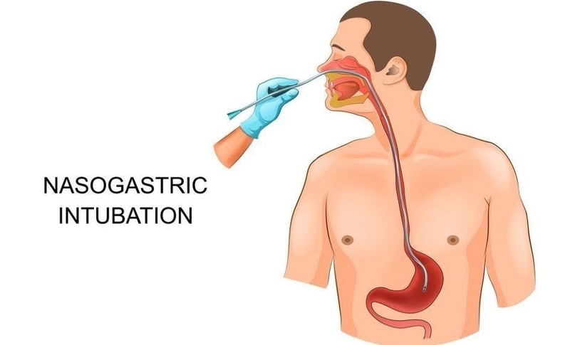 Liệt ruột sau mổ là gì? Phương pháp điều trị liệt ruột sau mổ 5