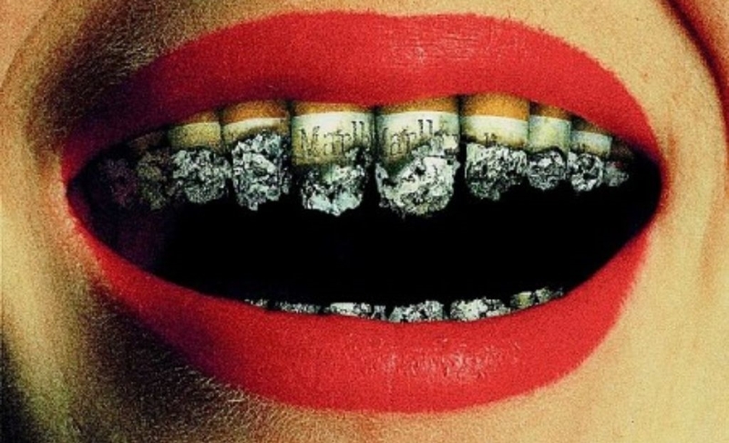 Liệu mất răng lâu năm có trồng được không? Kỹ thuật trồng răng nào tối ưu nhất? 2