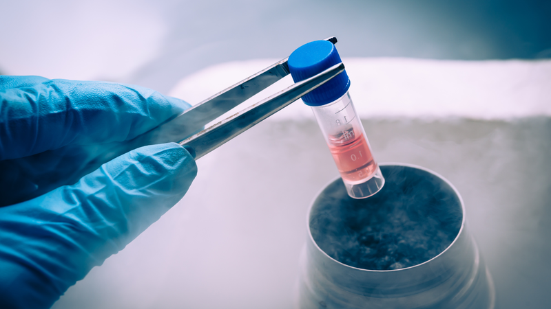 Liệu pháp tế bào gốc cho thấy triển vọng trong việc phục hồi hoạt động não sau đột quỵ 1