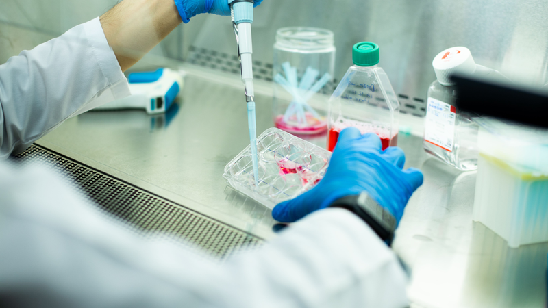 Liệu pháp tế bào gốc cho thấy triển vọng trong việc phục hồi hoạt động não sau đột quỵ 3