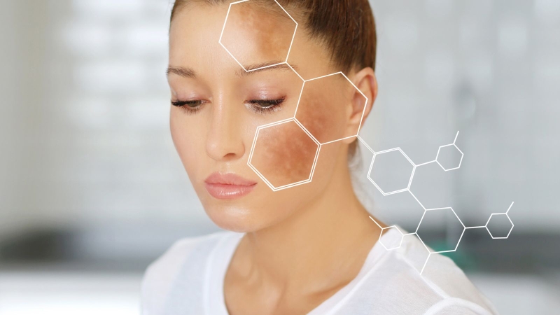Câu hỏi đốm đen trên da có nguy hiểm không là điều mà nhiều người quan tâm
