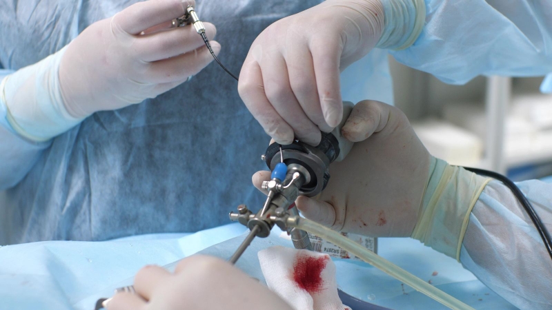 Nội soi vòm họng có đau không? Có gây lây nhiễm không? 3