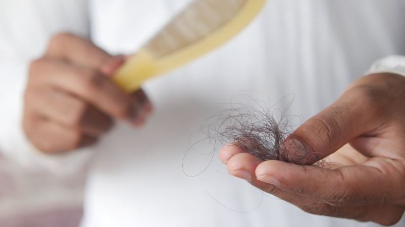 Nhiều bạn đặt câu hỏi tóc rụng không thấy chân tóc có sao không