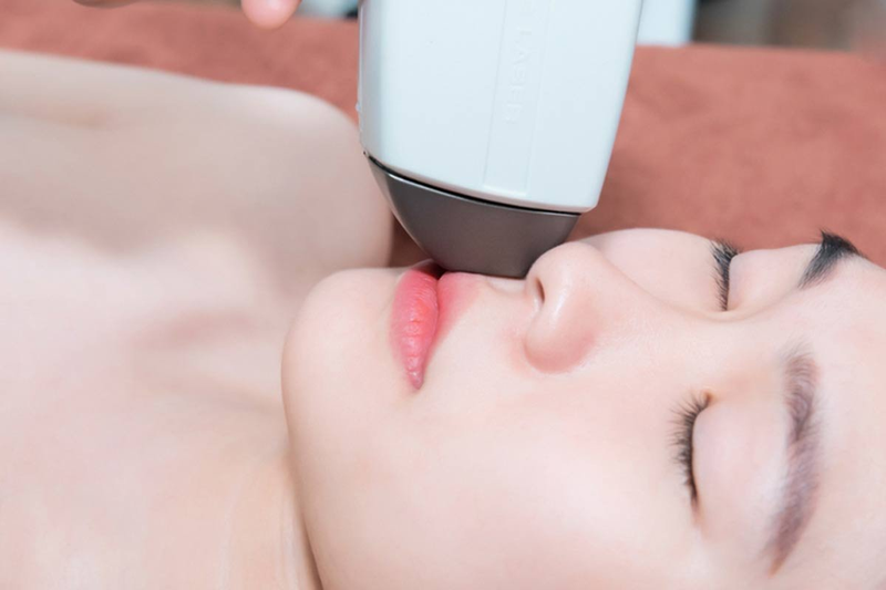 Liệu trình triệt ria mép hết bao nhiêu tiền? 2