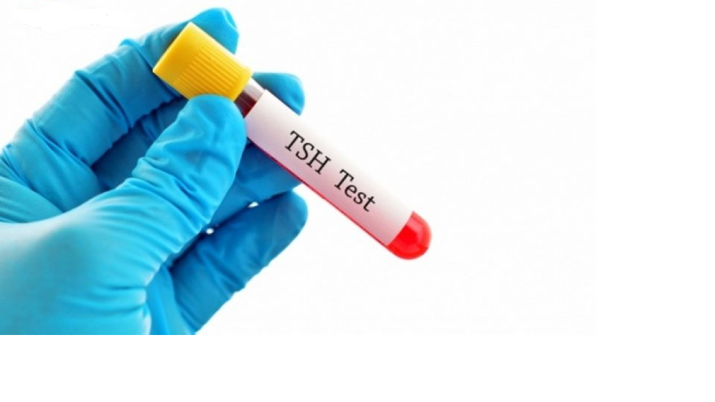Liệu xét nghiệm bướu cổ có cần nhịn ăn hay không 3