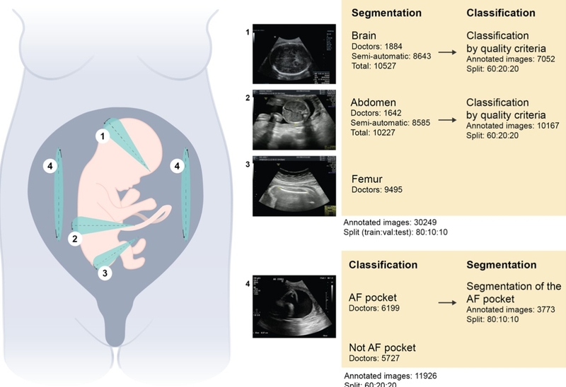 LMP là gì? Những chỉ số quan trọng khi siêu âm mẹ nên biết 2
