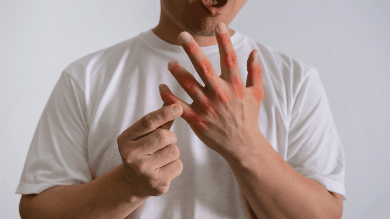 Loại rau thơm có thể giảm axit uric nhờ kháng viêm và lợi tiểu 2