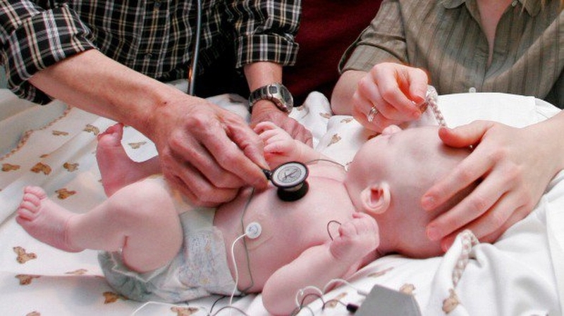 Loạn sản phổi ở trẻ sơ sinh: Nguyên nhân, triệu chứng và cách điều trị 1