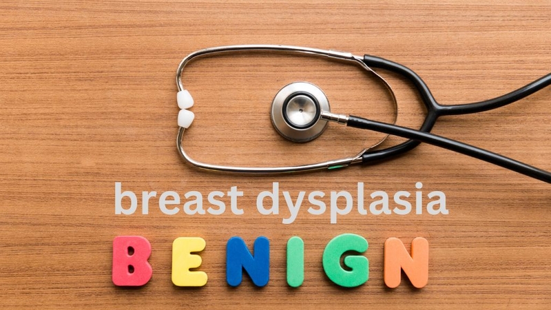 Loạn sản vú lành tính là gì? Dấu hiệu nhận biết và hướng xử lý 1
