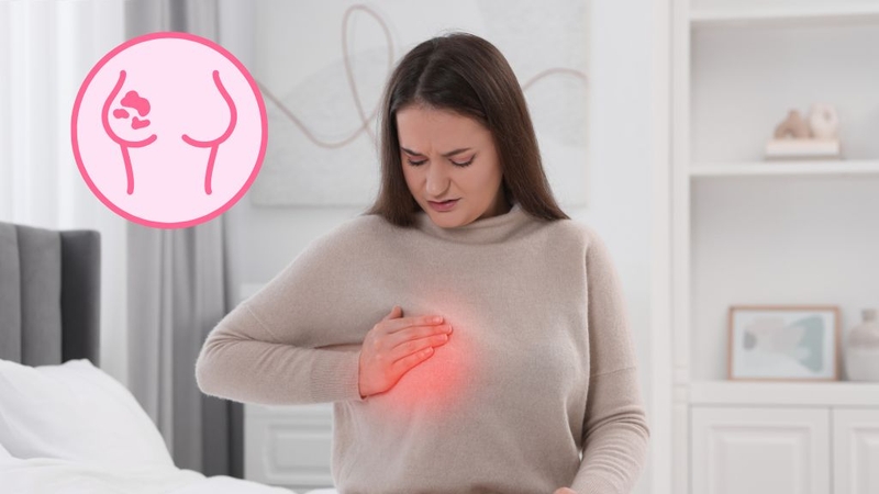 Loạn sản vú lành tính là gì? Dấu hiệu nhận biết và hướng xử lý 3