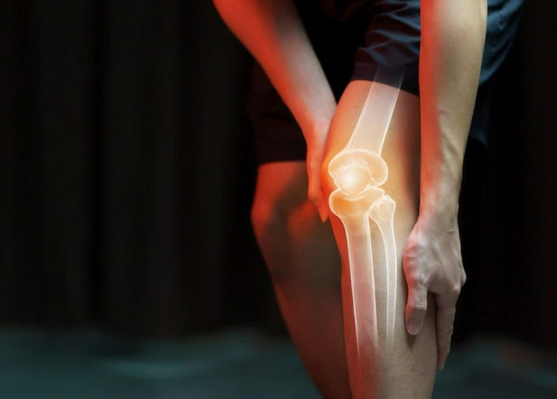 Loạn sản xơ xương: Nguyên nhân, các phương pháp chẩn đoán và điều trị 1