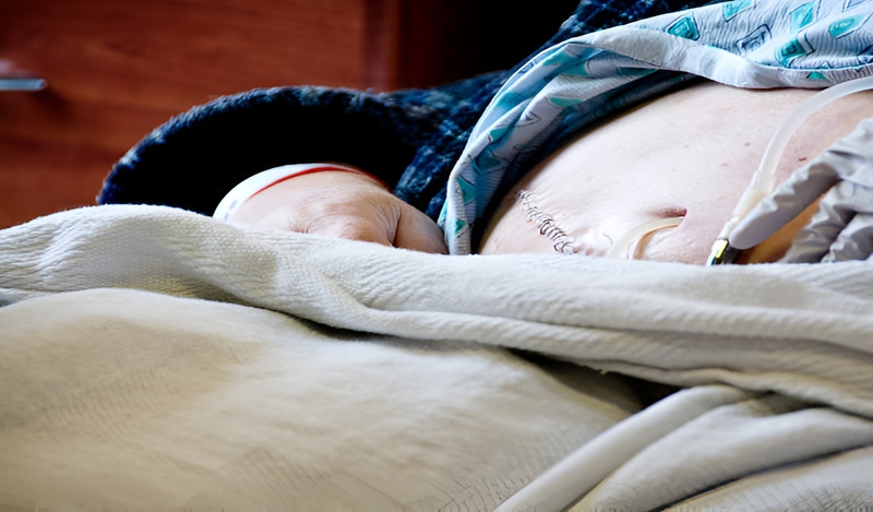 Lọc màng bụng trong suy thận: Phương pháp điều trị hiệu quả và tiện lợi 2