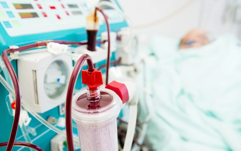 Lọc máu có nguy hiểm không? 3