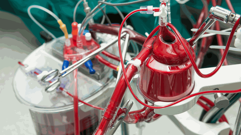 Lọc mỡ máu và những thông tin cần biết 2