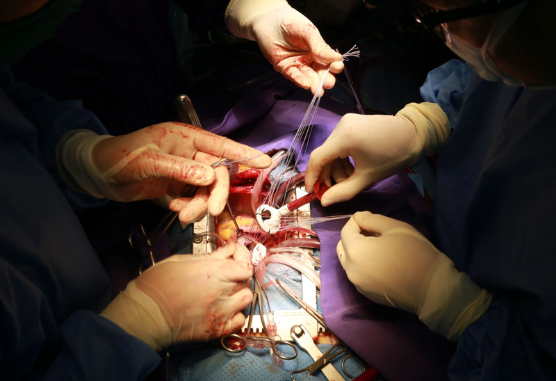 loi-ich-va-rui-ro-cua-phau-thuat-thay-van-tim 2.png