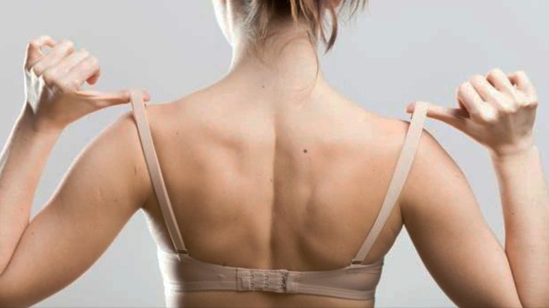 Lợi ích và rủi ro khi hút mỡ vai 2