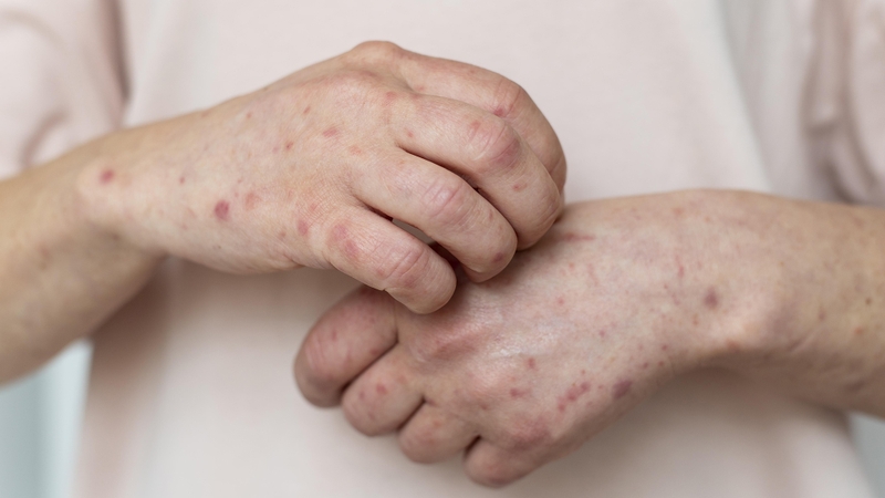 Lời khuyên khi đi bơi: Những ai không nên đi bơi? 4