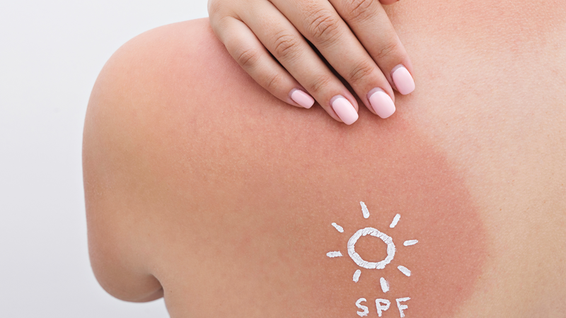 SPF (Sun Protection Factor) thể hiện khả năng chống tia UVB của sản phẩm