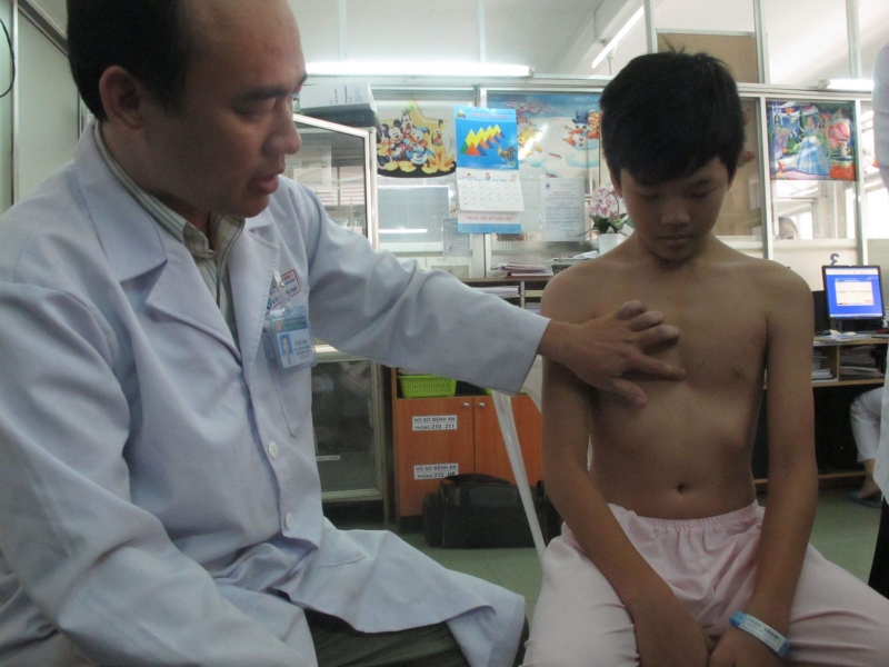 Lõm ngực có phải mổ không? 1