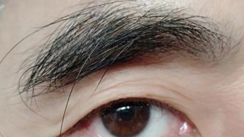 long-may-dai-bat-thuong-la-tot-hay-xau 1.jpg