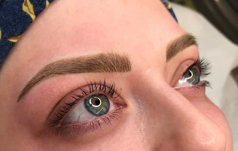 Lông mày trổ đỏ là gì? 6 nguyên nhân gây ra phổ biến nhất 3