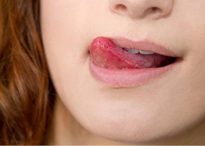 Nguyên nhân và cách trị dứt điểm khô môi để trang điểm dễ dàng hơn 1