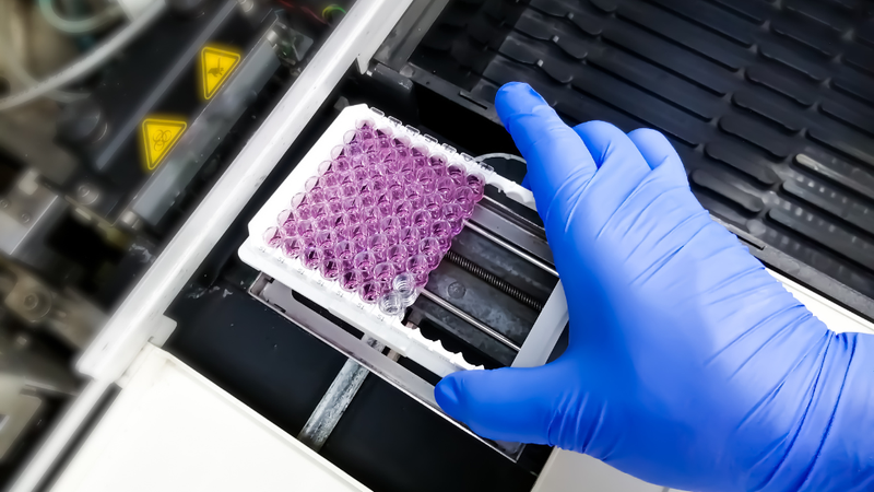 lpa-la-gi-tam-quan-trong-cua-lpa-trong-dieu-tri-va-phong-benh 1