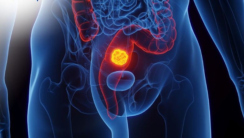 Lúa mì và lúa mạch có giống nhau không? Những lưu ý khi sử dụng để bảo vệ sức khỏe 4