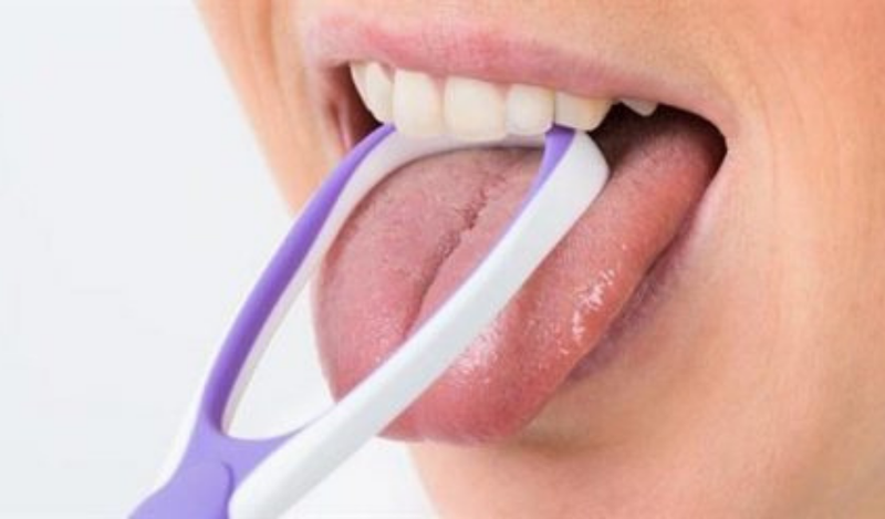 Vệ sinh răng miệng sạch sẽ giúp hạn chế lưỡi bị trắng