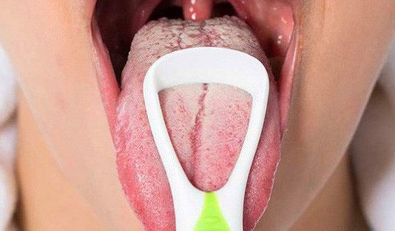 Lưỡi lông đen là gì? Cách xử lý lưỡi bị đen sau khi ngủ dậy 4