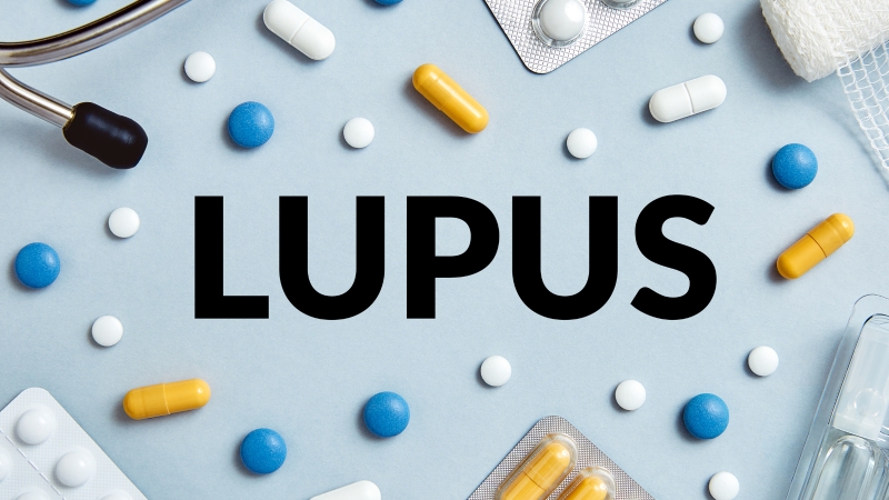 Lupus ban đỏ có chữa được không?