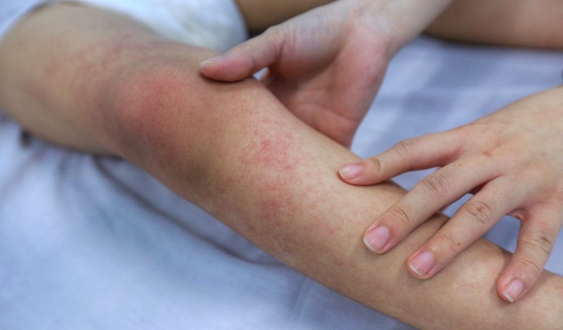 Lưu ngay cách đuổi muỗi bằng sả vừa hiệu quả vừa thơm nhà 1