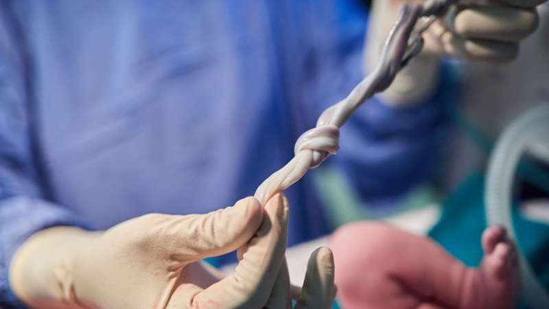 Máu cuống rốn là nguồn lưu trữ tế bào gốc phổ biến