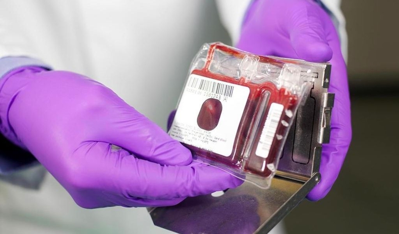 Lưu trữ tế bào gốc là gì? Mục đích và quy trình thu thập tế bào gốc? 3