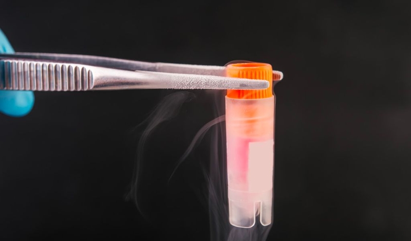 Lưu trữ tế bào gốc là gì? Mục đích và quy trình thu thập tế bào gốc? 2