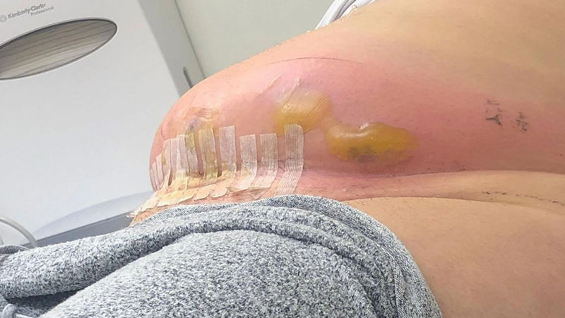 Lưu ý 5 tai biến sản khoa thường gặp trong quá trình sinh nở 3