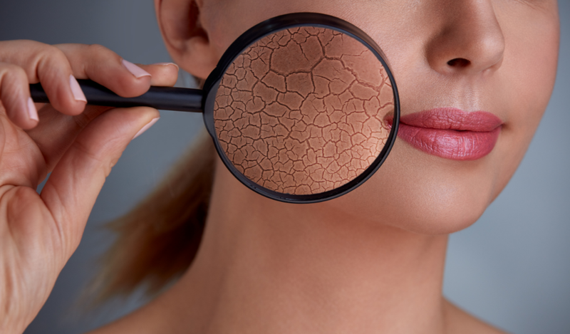 chọn kem chống nắng cho da khô vào mùa hè