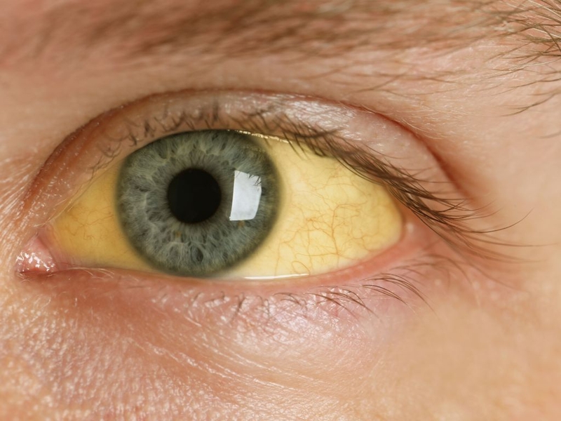 Lưu ý khi sử dụng thuốc điều trị bệnh gan mà người bệnh nên biết 2