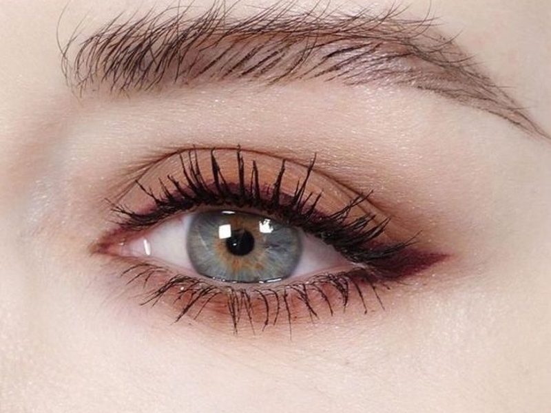 Lưu ý: Những ai không nên mổ lasik? 2