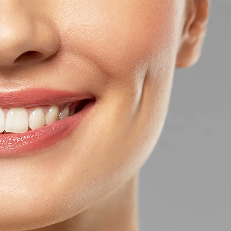 Má lúm đồng tiền có bị mất không 1?